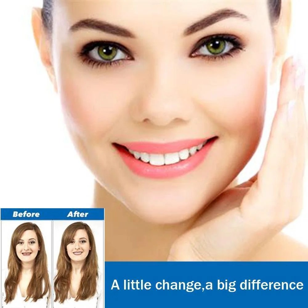 Magic Smile Teeth Brace - Image 2