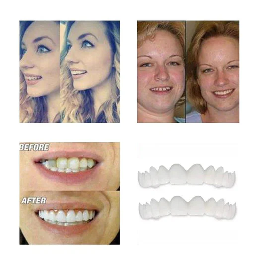 Magic Smile Teeth Brace - Image 6