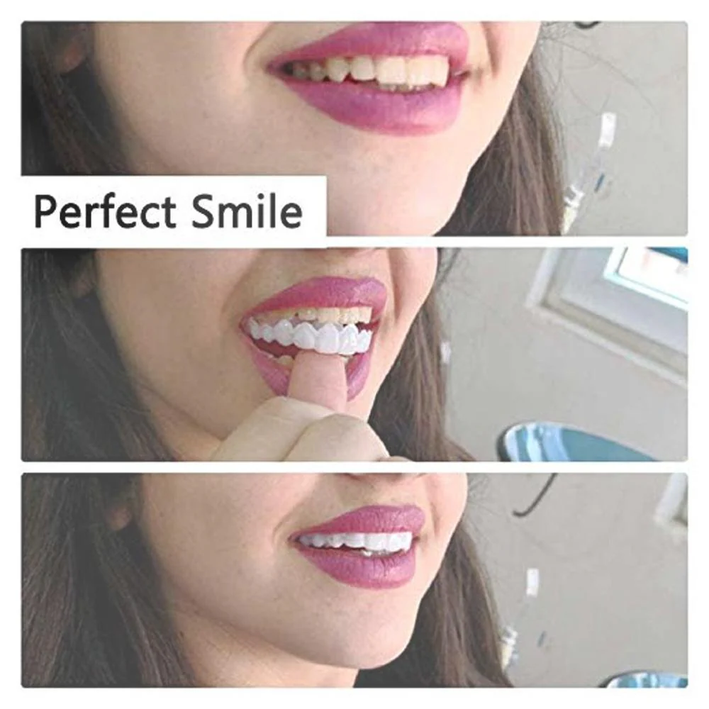 Magic Smile Teeth Brace - Image 7