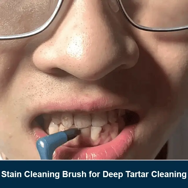 Tooth Stain Cleaning Brush - Image 2
